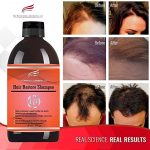 Hair Restoration Shampoo review